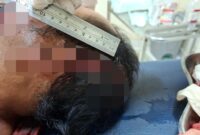 1761672950581-mj-korban-penebasan-parang-oleh-saudara-kandung-di-lombok-timur-minggu-26102025-mj-dianiaya-akibat-sengketa-tanah-warisan-dok--1761661567083_169