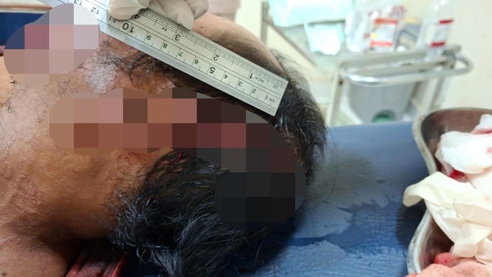1761672950581-mj-korban-penebasan-parang-oleh-saudara-kandung-di-lombok-timur-minggu-26102025-mj-dianiaya-akibat-sengketa-tanah-warisan-dok--1761661567083_169