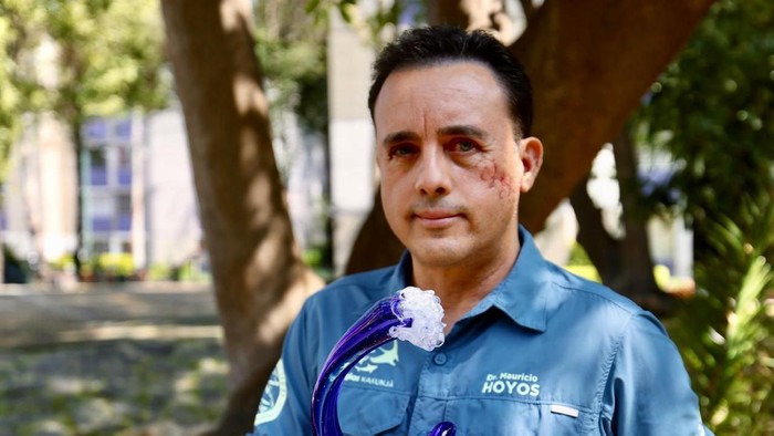 1763357829842-testimoni-seorang-peneliti-setelah-kepalanya-digigit-hiu-hewan-ini-membiarkan-saya-hidup-1763355666689