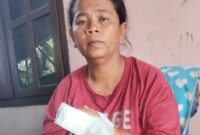 1767006358476-wanita-di-gresik-korban-penganiayaan-penagih-utang-bank-plecit-1766978218129_169