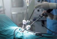 1767805546090-ilustrasi-operasi_169